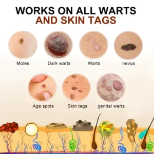 Lenaro™ Bee Venom Mole and Wart Treatment Cream