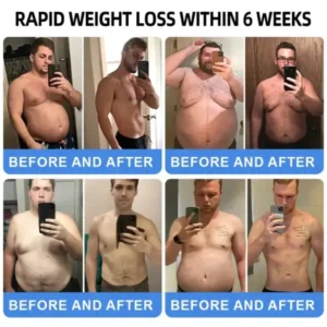 NIDDK-Tirzepatide Nano Microneedle Patch