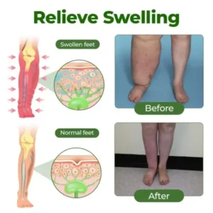 Timilk®Professional Leg Circulation Cream